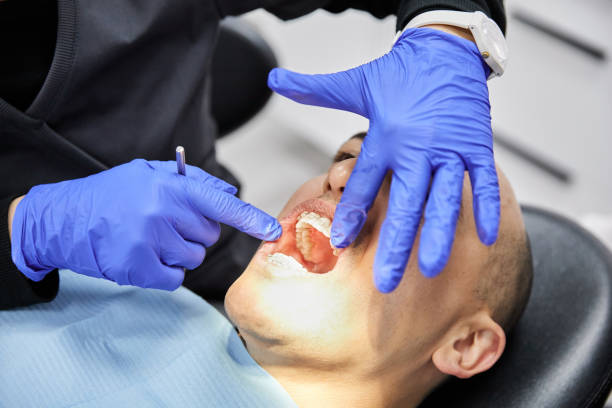 Best Dental Abscess Treatment in Canal Winchester, OH